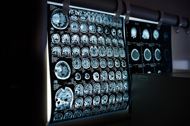 Body scan techniques